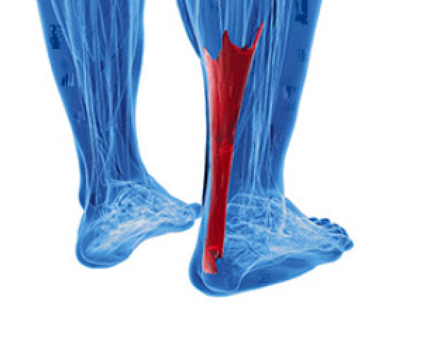 Calf Tendon Pain: Causes, Conditions And Treatment